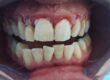 Come ho salvato i denti di Luisa dalla parodontite (prima)