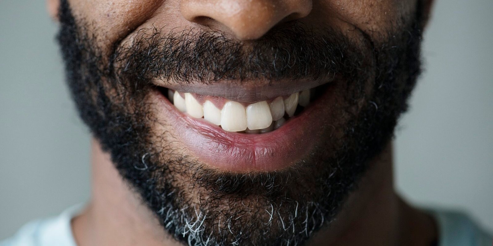 Closeup of smiling teeth of a black man