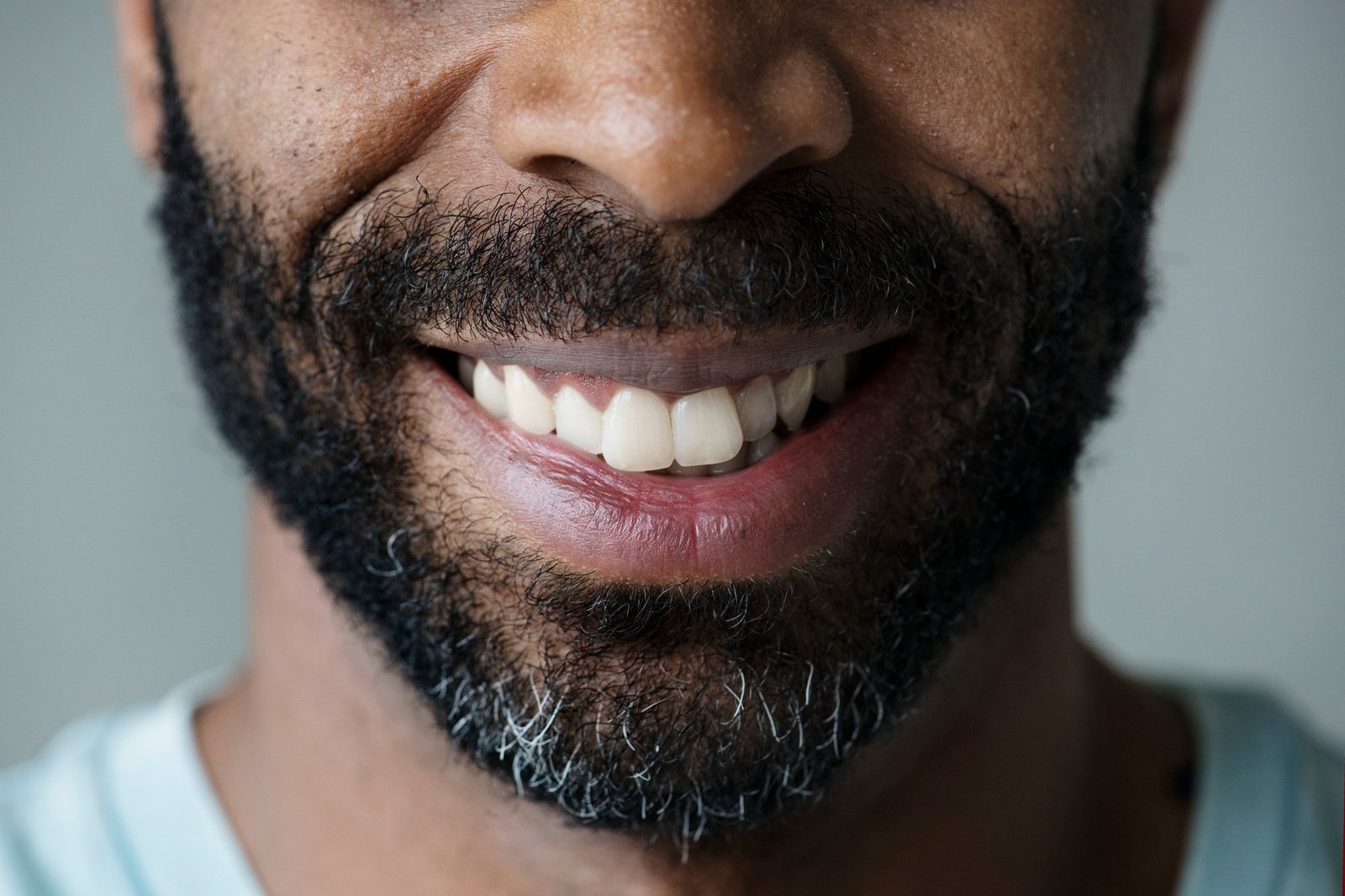 Closeup of smiling teeth of a black man Closeup of smiling teeth of a black man