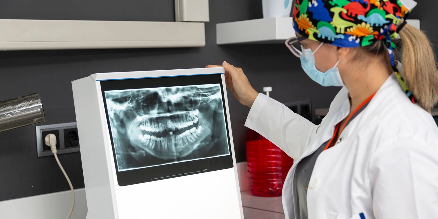 Female dentist viewing a dental x-ray of a patient La radiografia nei denti dei bambini