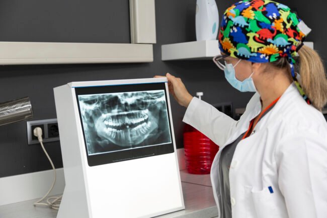 La radiografia nei denti dei bambini