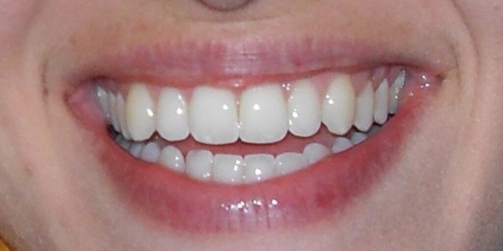 bel sorriso ancona