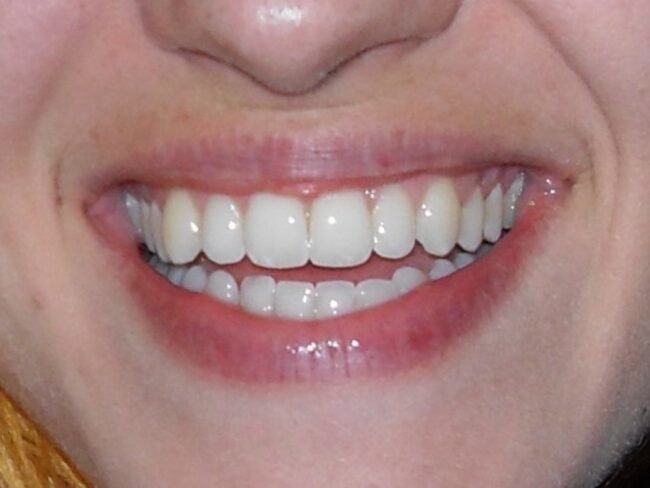 bel sorriso ancona
