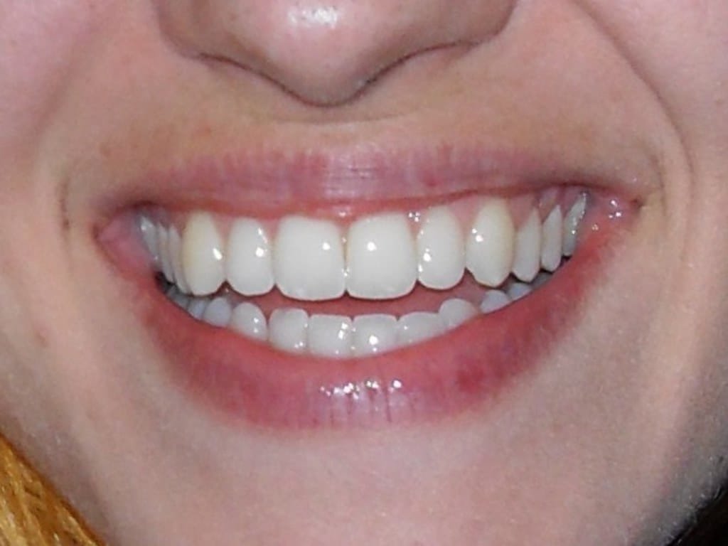 bel sorriso ancona bel sorriso ancona