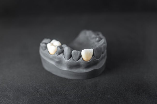 capsula dentale ancona