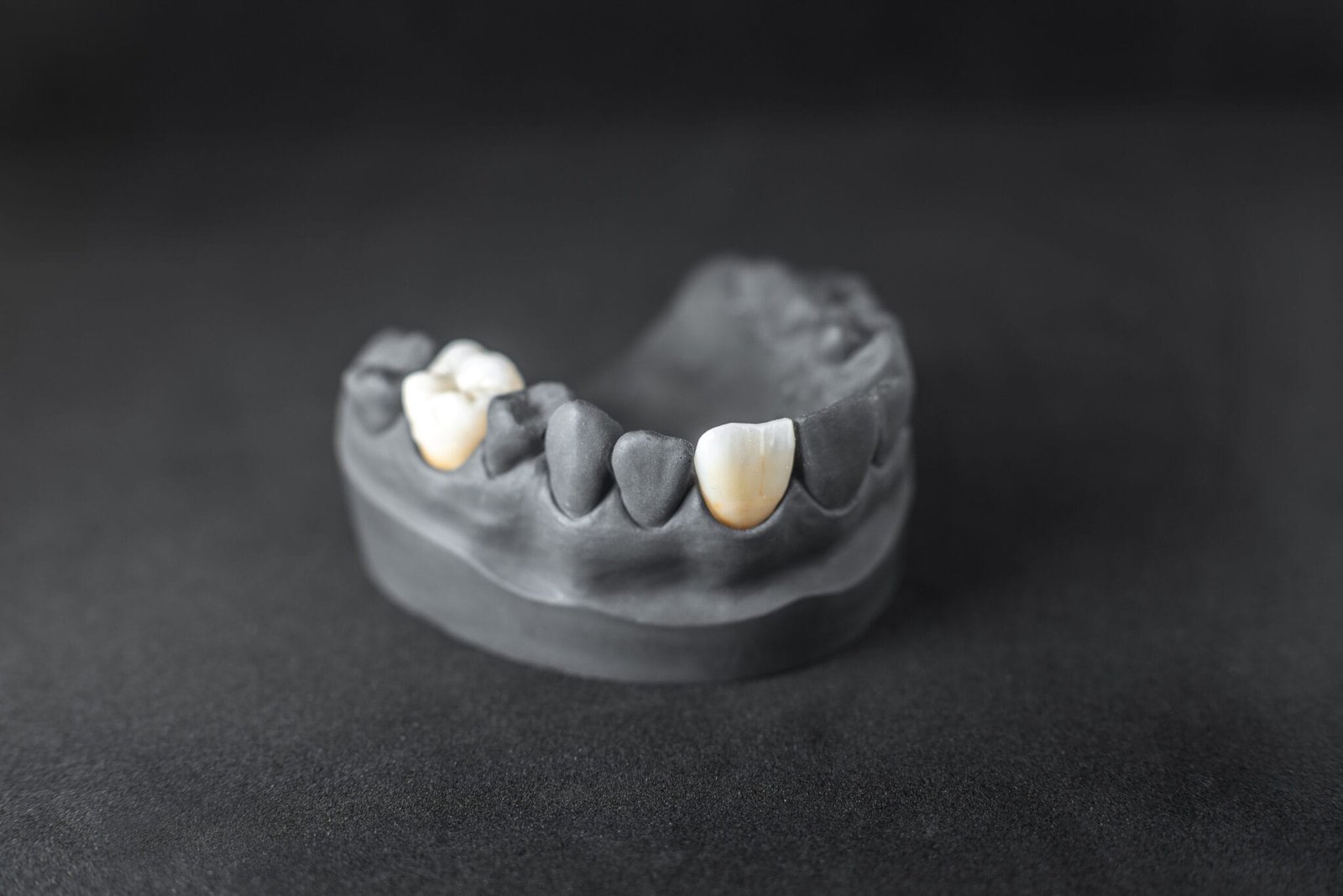 capsula dentale in una impronta capsula dentale ancona