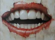 denti in zirconio o in ceramica