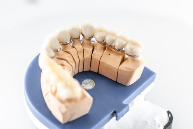 Protesi dentale dentista Ancona