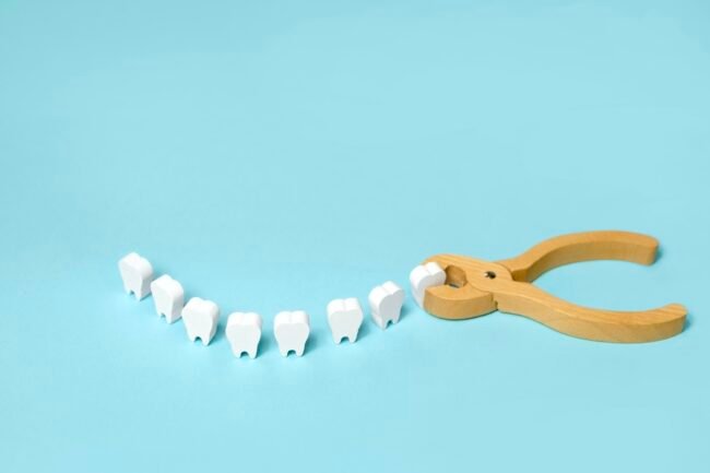Tooth extraction with a dental instrument with forceps. Tooth extraction with a dental instrument with forceps.